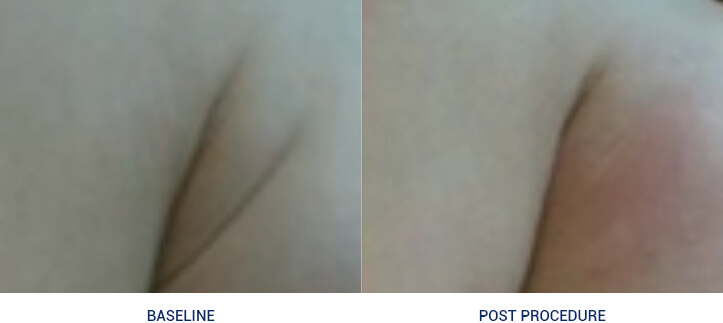 uf_cases15